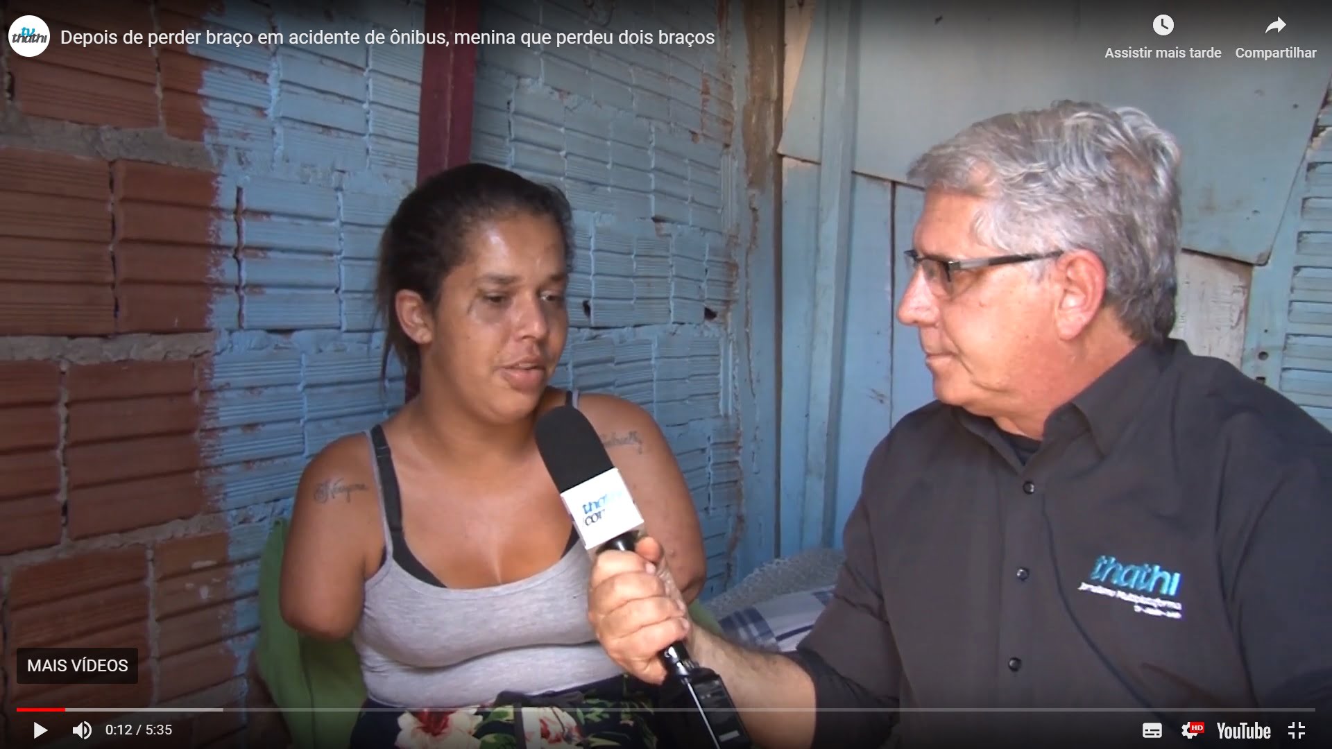 mulher sem braço prótese