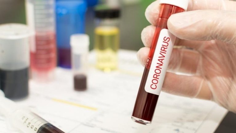 Brasil tem 22,1 mil casos de covid-19; mortes chegam a 1,2 mil