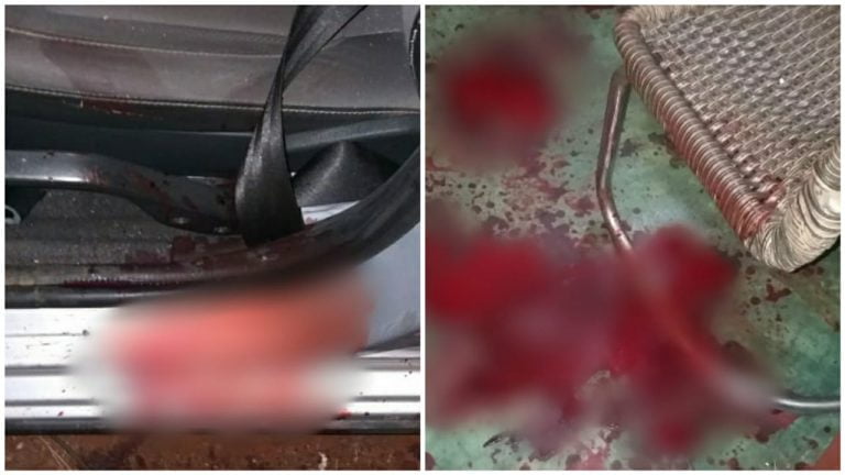 Homem é baleado em tentativa de execução no Parque Ribeirão