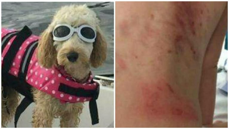 Cão salva menino com síndrome de Down preso em secadora durante brincadeira de pique-esconde