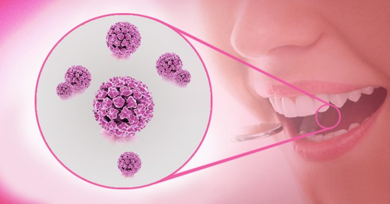 Cresce risco de câncer de boca associado ao vírus HPV em São Paulo, aponta estudo