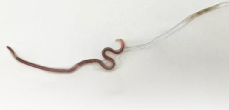 Verme é encontrado na garganta de japonesa após consumir sashimi