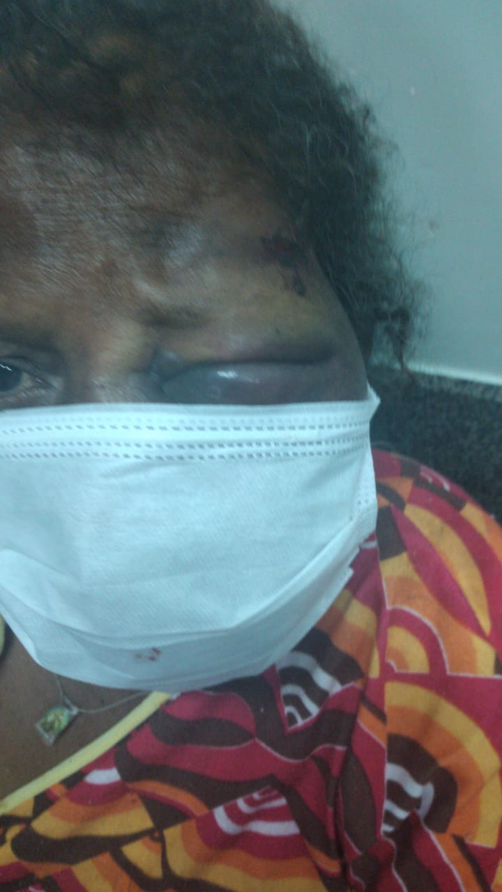 Vídeo | Mulher de 65 anos é agredida com soco no rosto, desmaia e acaba no hospital