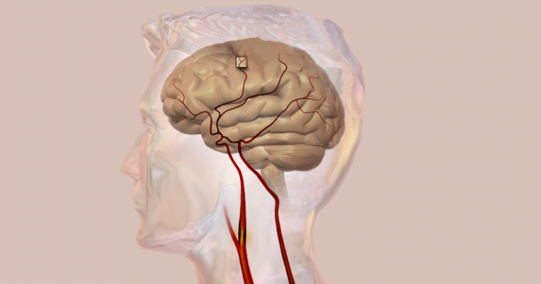 USP precisa de voluntários para estudo do conhecimento médico sobre morte encefálica e doação de órgãos