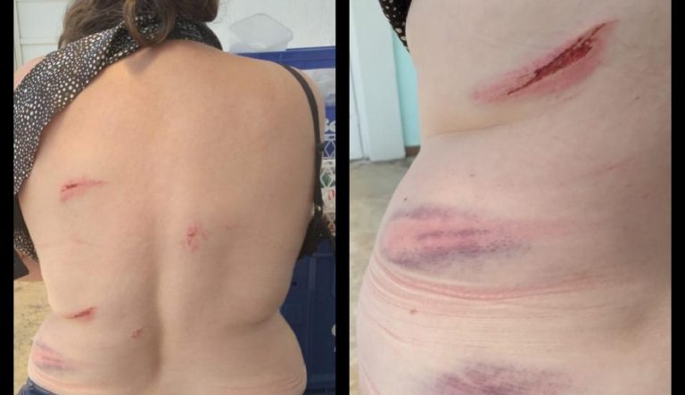 Pais e adolescente agridem comerciante por não vender bebidas alcoólicas durante a quarentena em São Carlos