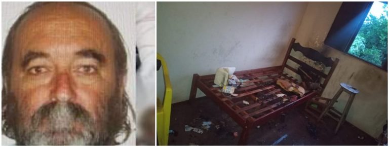 Morre padrasto queimado pela enteada em Patrocínio Paulista