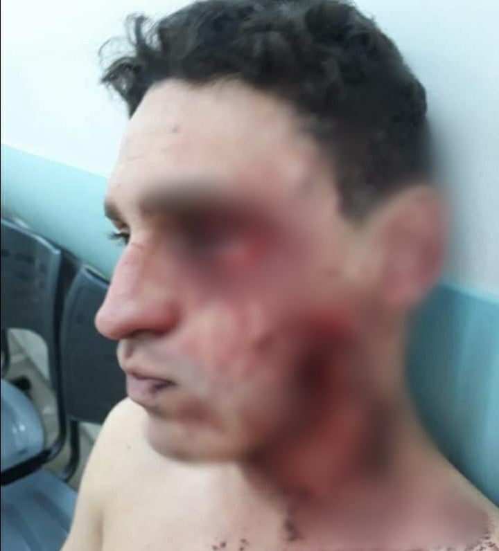 Festa clandestina | Jovem derruba uísque, é agredido e pode perder a visão