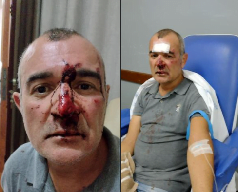 Homem é agredido durante assalto em Monte Alto