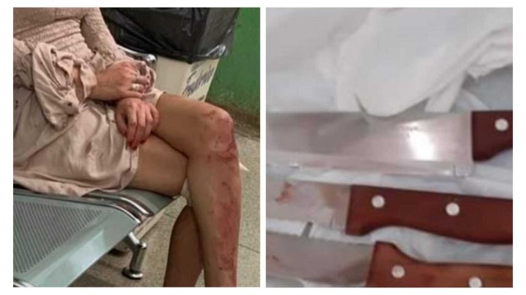 Mulher atinge com facadas estudante de medicina