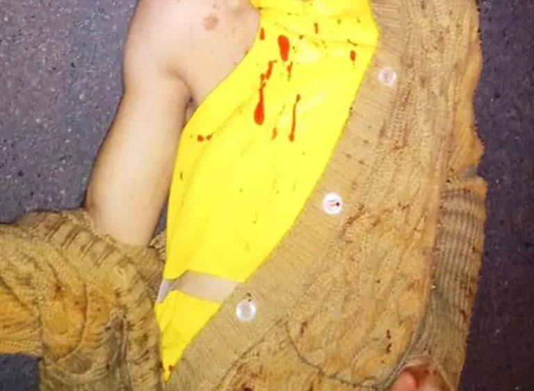 Travesti é espancada, sofre ferimentos graves e é internada na UTI