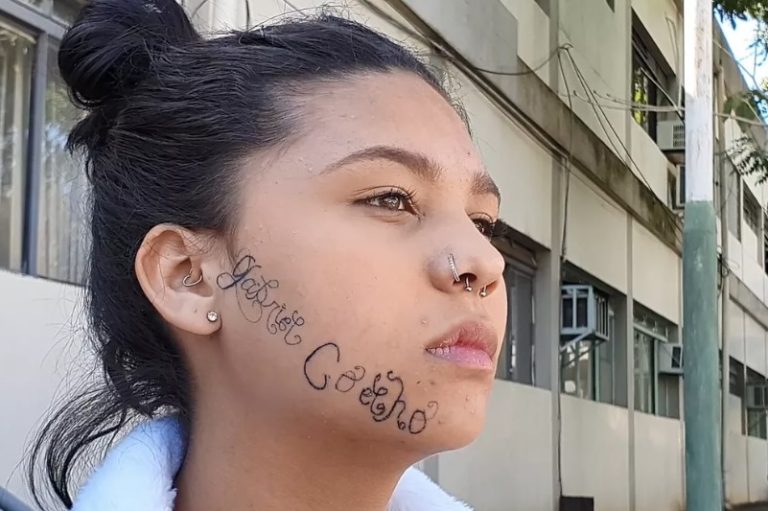 Jovem tem nome do ex-namorado tatuado à força
