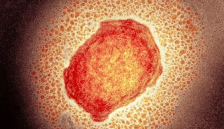 Março foi o mês do ano com mais casos confirmados de Mpox em Ribeirão