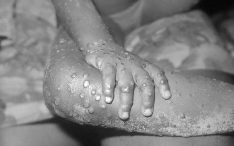 OMS declara varíola dos macacos como emergência de saúde global