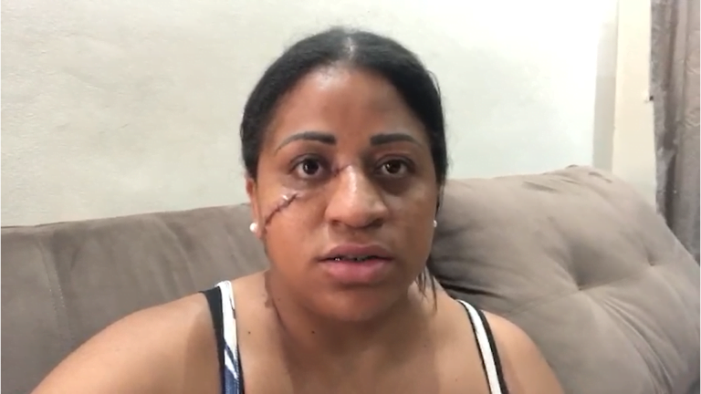 Motociclista acidenta-se com cerol e faz apelo por vídeo