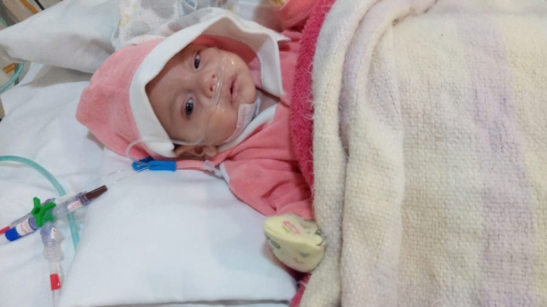 Morre bebê que sofreu queimadura no pé