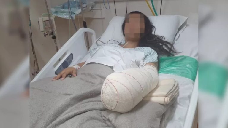 Mulher de 24 anos vai a hospital para dar à luz, mas acaba com a mão amputada