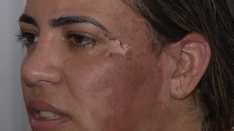 Homem que jogou água quente em mulher é preso