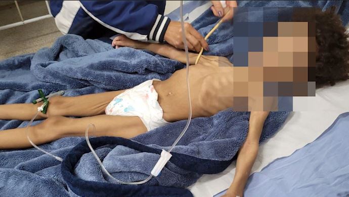 40 dias sem comer: criança de 3 anos é encontrada em situação de maus tratos, em Rio Claro