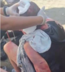 Homem que invadiu prédio pelado em Cubatão e esfaqueou vizinho é preso