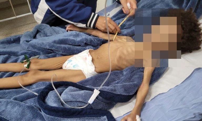 Criança resgatada em estado de desnutrição em Rio Claro tem alta do Hospital