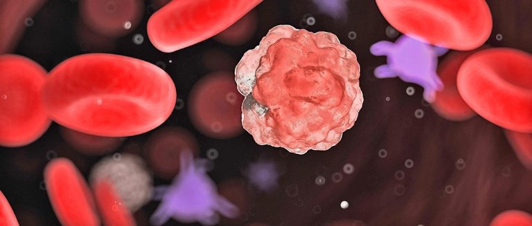 Leucemia: entenda o câncer que afeta as células sanguíneas