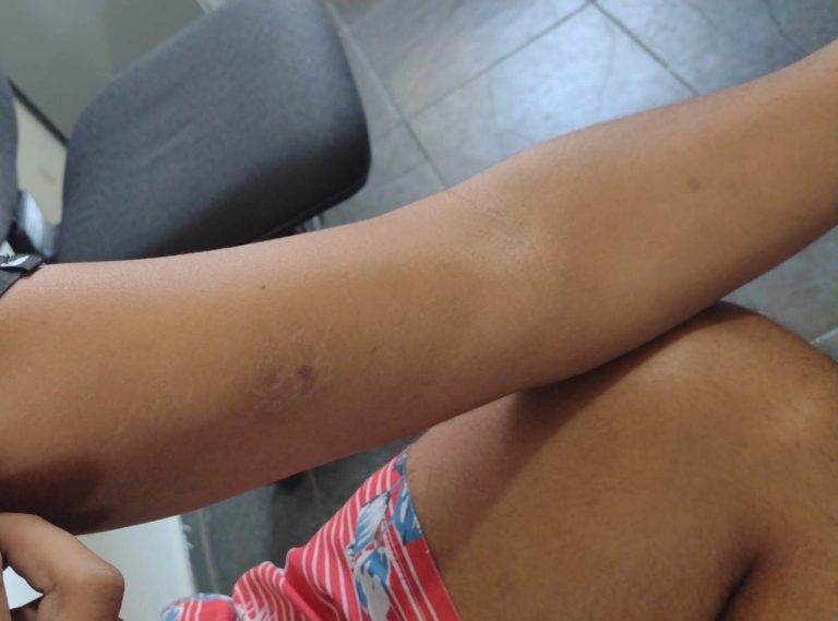 Homem é preso após roubar veículo e agredir mulher em Itanhaém