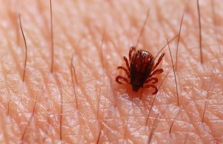 Moradora de Americana infectada em Limeira tem morte confirmada por febre maculosa