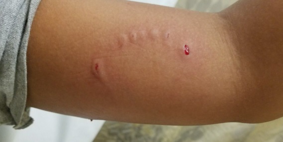 Raiva humana: casos no Brasil fazem SP entrar em alerta; São José dos Campos disponibiliza vacinas em 3 pontos