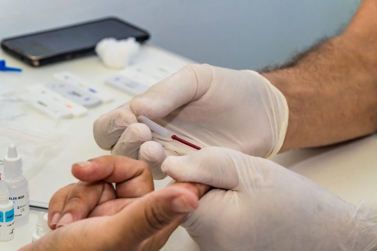 CTA de Bertioga realiza testes contra infecções sexualmente transmissíveis