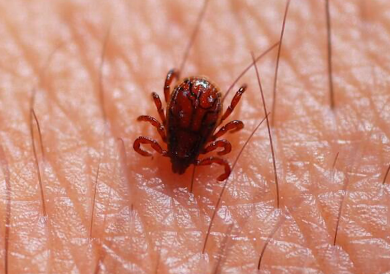 Segunda morte por Febre Maculosa é confirmada em Limeira