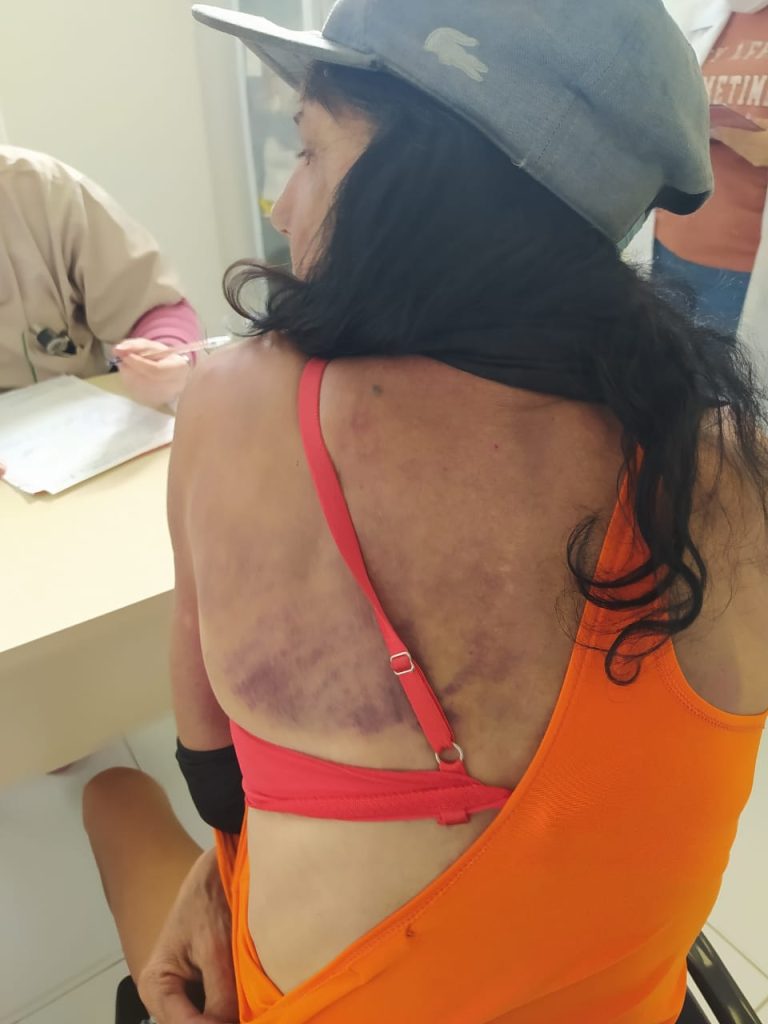 Mulher é espancada por companheiro em Americana