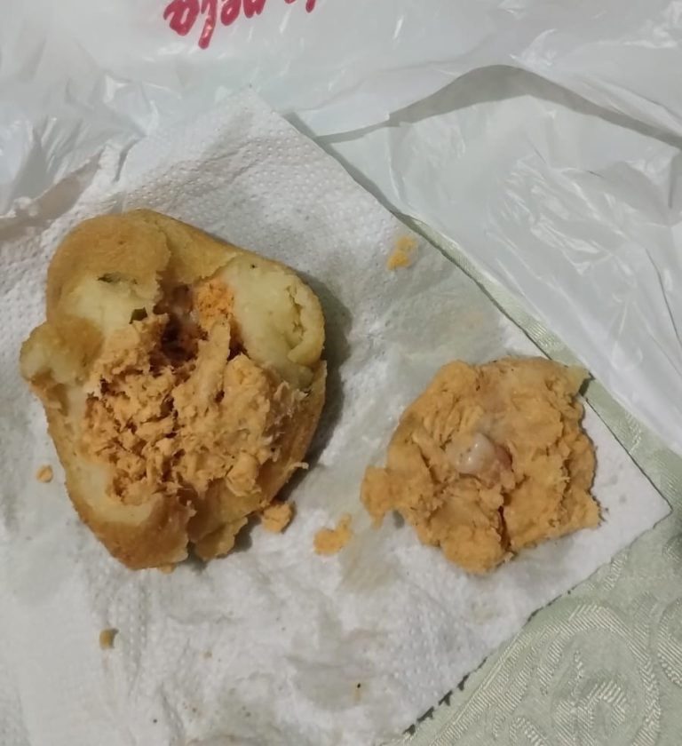 Mulher encontra dente humano após comer coxinha no Litoral