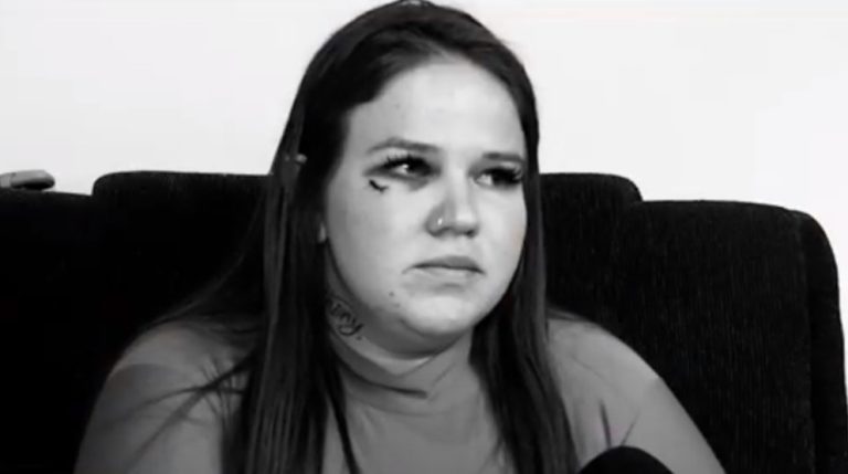 Ex covarde! Mulher agredida pelo ex-marido relata momentos de horror