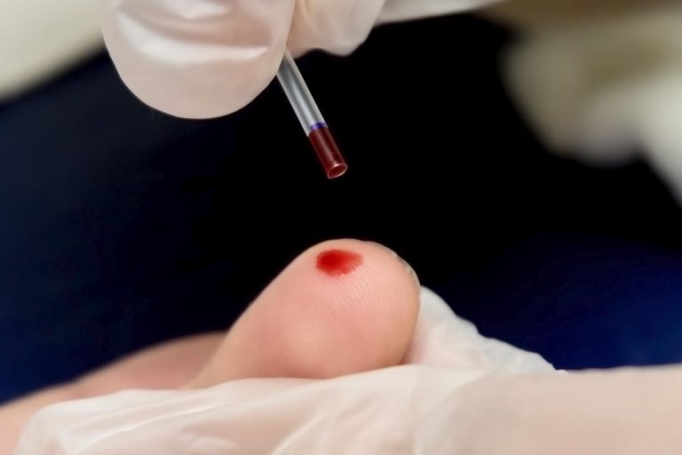 Campanha oferece testagem e vacinação contra hepatites em RP