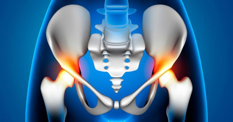 Mais de 8 mil pacientes esperam no SUS por cirurgia de quadril