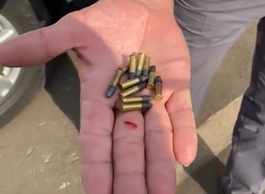 Catador de recicláveis é baleado após ter sido confundido com ladrão em Limeira