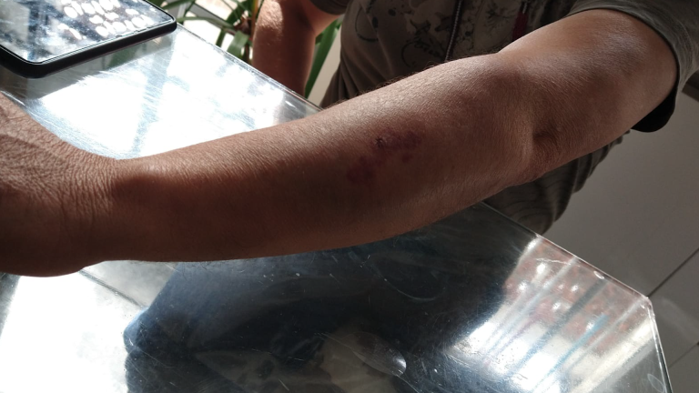 Vigia é feito refém por bandido armado com faca em Campinas; polícia intervém