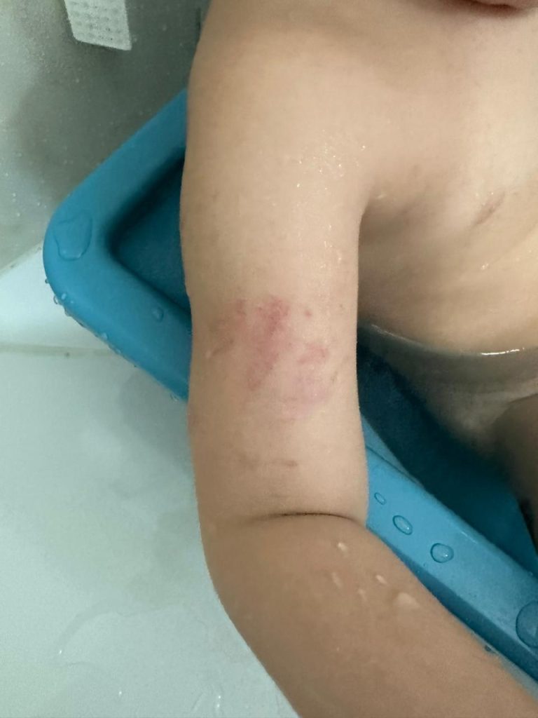 agressão criança autista taubaté