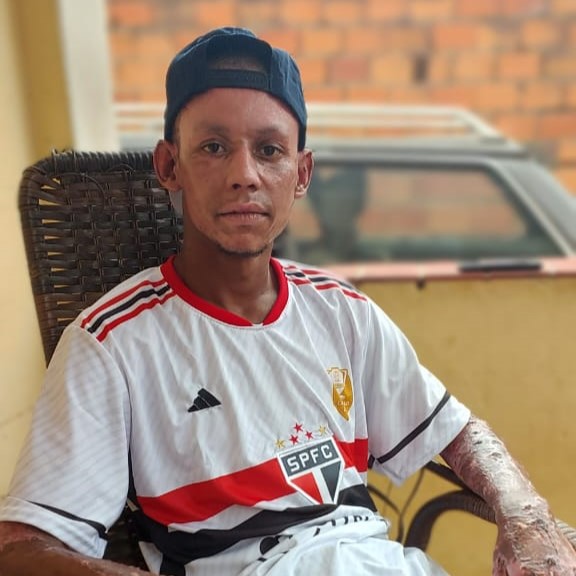 Vítima de explosão em Santa Bárbara d’Oeste recebe alta