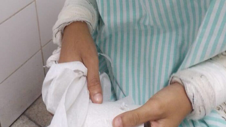 Adolescente de 17 anos sofre traumatismo craniano ao ser agredida por ciúme