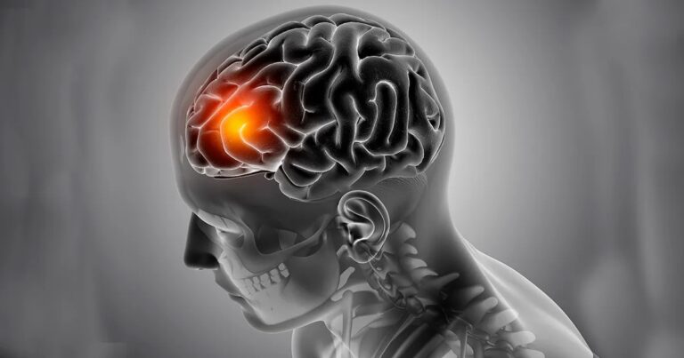 SUS incorpora protocolo de atendimento para pacientes com AVC isquêmico