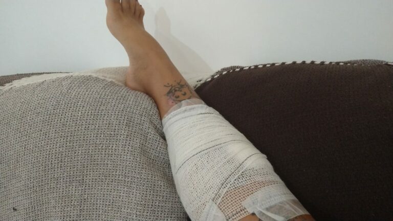 Mulher feita de escudo humano fala pela primeira vez