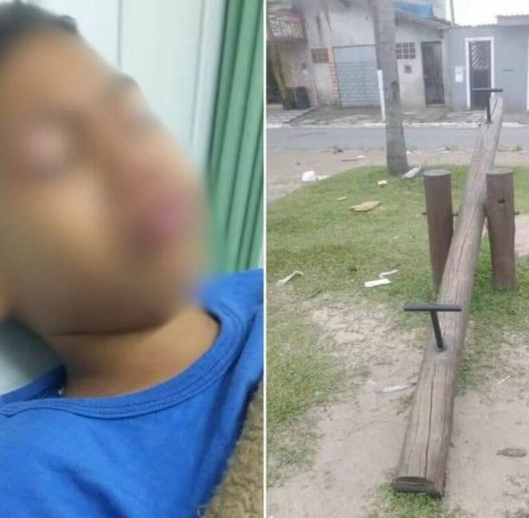 Menino de 7 anos fere genitália em gangorra no litoral de SP