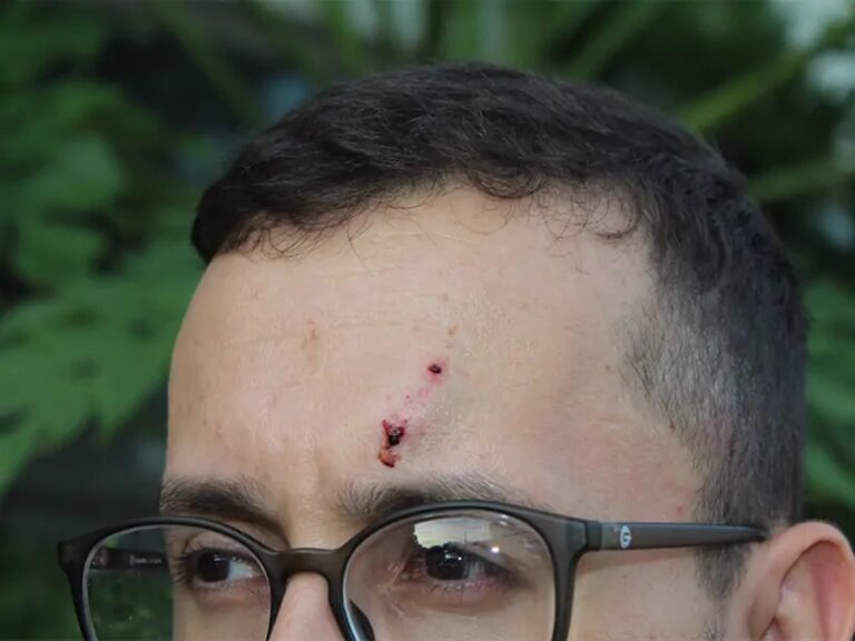 Socorristas do SAMU são agredidos durante assalto na região