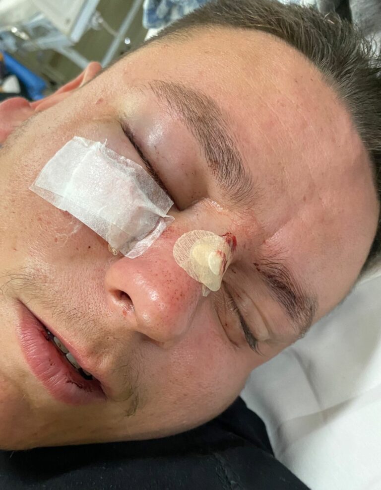 cotovelada pm jacareí