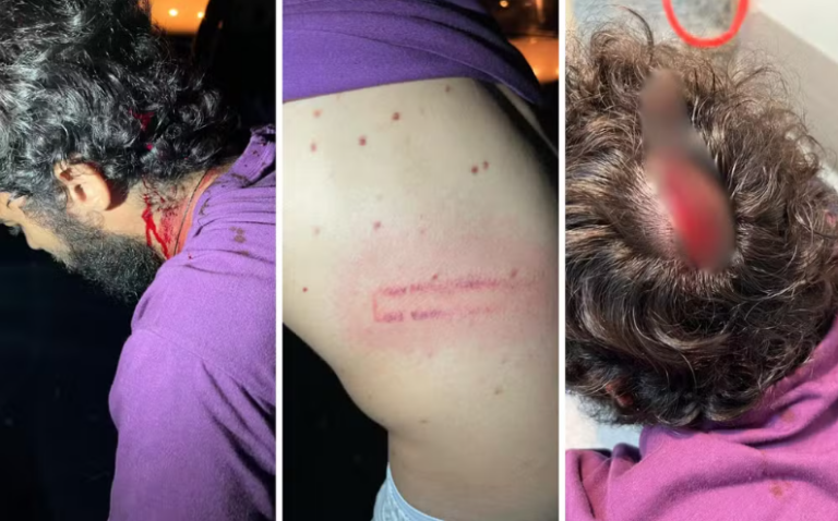 Publicitário denuncia agressão por policiais militares após bloco de carnaval