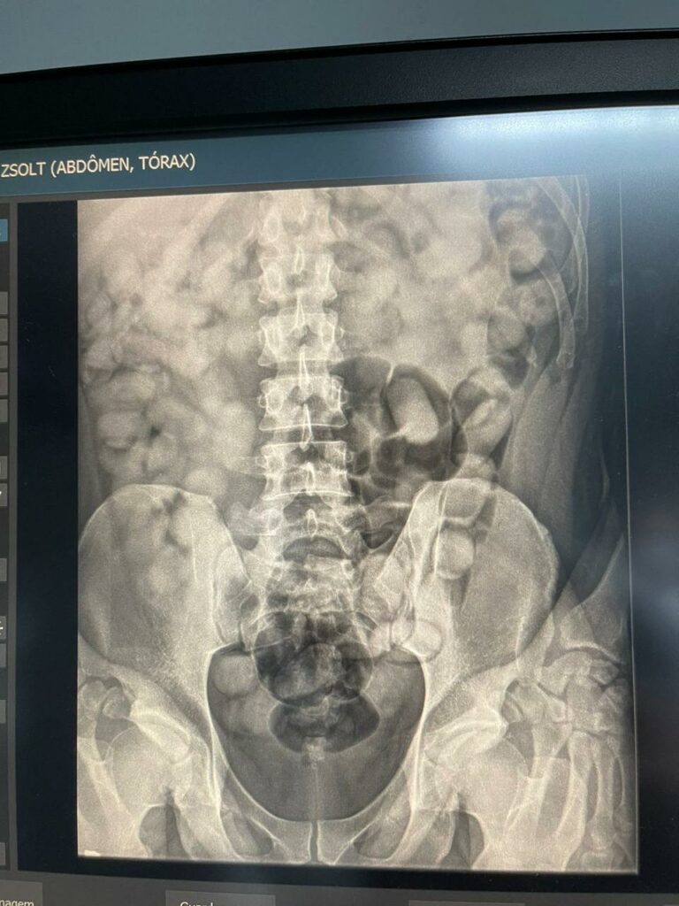 Polícia Federal prende dois homens tentando embarcar com cocaína para Europa em Viracopos