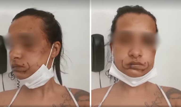 Jovem suspeito de agredir e arrancar parte do lábio da ex-companheira é preso em General Salgado