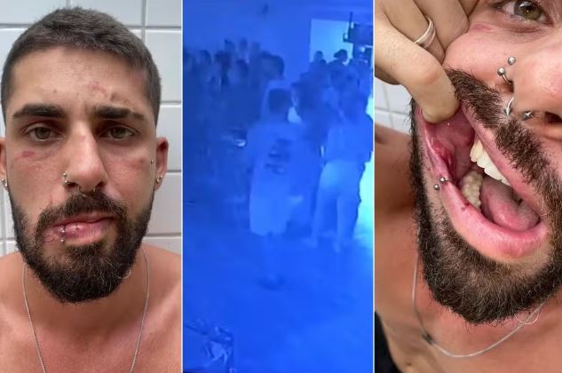 Homofobia: Dançarino é espancado após apresentação em bar de São Vicente