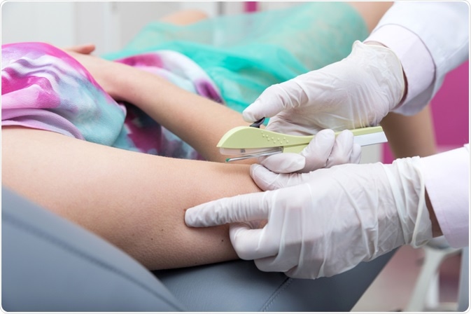 São Vicente: Mutirão de implante contraceptivo gratuito acontece neste sábado